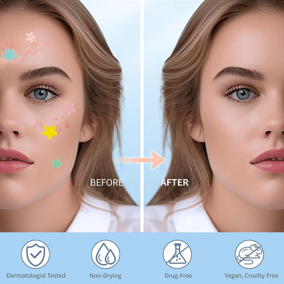 Pimple Patches for Face, Hydrocolloid Acne Patches, Cute Star Zit Covers, Colorful Spot Stickers with Tea Tree, Salicylic Acid & Cica Oil| 3 Sizes (10Mm, 12Mm & 14Mm) |400 Count